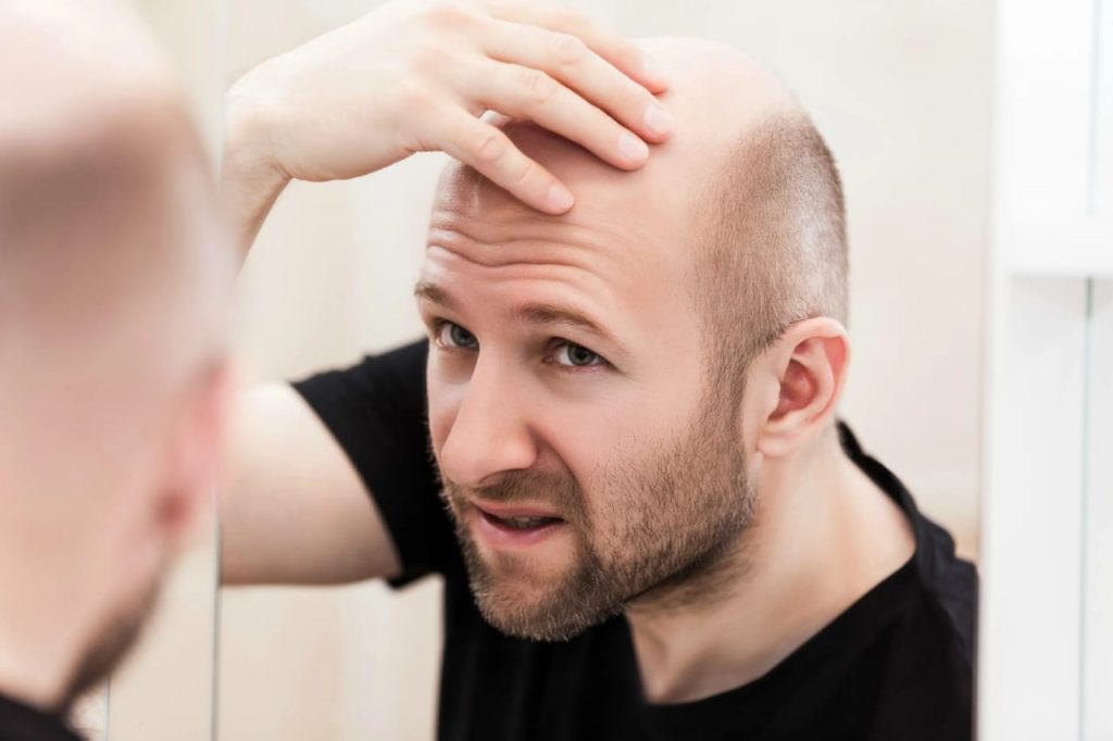 haircut for a balding man